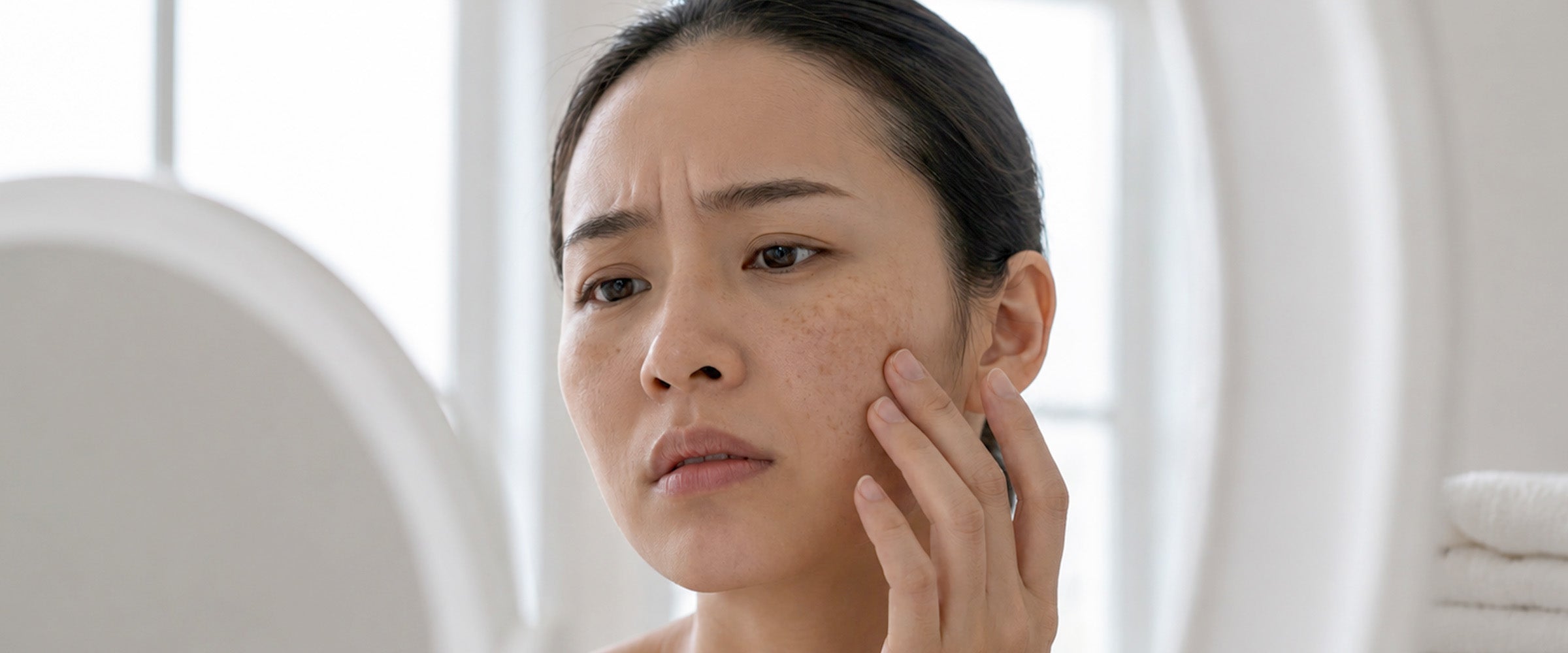 Women with Melasma and Hyperpigmentation looking in the mirror