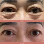 Wrinkle Blur Eye Brightener - Olivia Quido Clinical Skincare