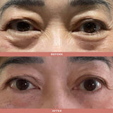 Wrinkle Blur Eye Brightener - Olivia Quido Clinical Skincare