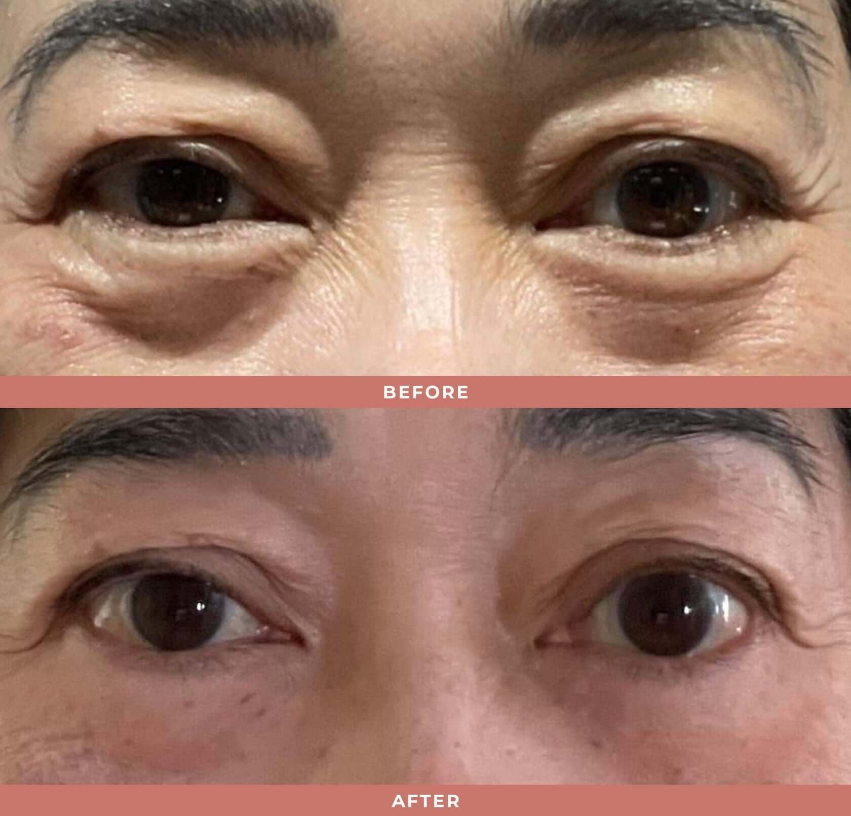 Wrinkle Blur Eye Brightener - Olivia Quido Clinical Skincare