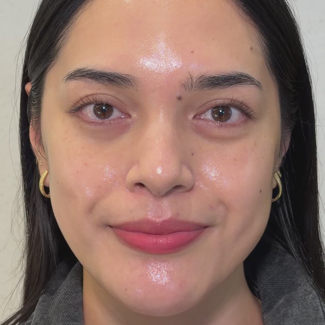 O Skin Med Spa 10 Billion Exosomes Booster Treatment, After video, glassy skin